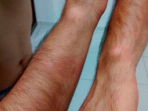 Emprsário tem marcas de agressão em todo o corpo (Foto: Arquivo Pessoal)